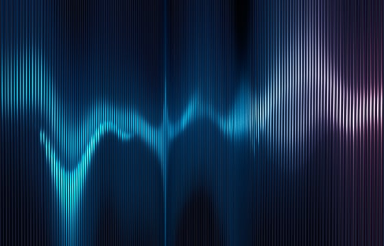 Transforming Customer Service – Turning Audio Data into Strategic Insights with SonicVUE